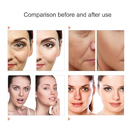 Theroheal 7 Color Light LED Face Mask